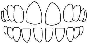 Dental diagram showing spacing between teeth