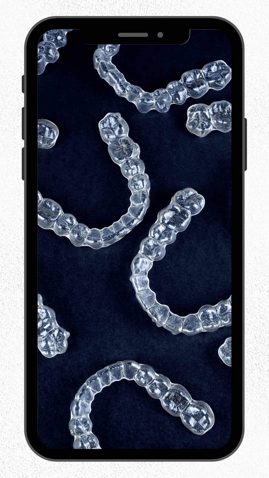 Clear aligner manufacturing technology