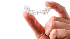 how clear aligners work (1)