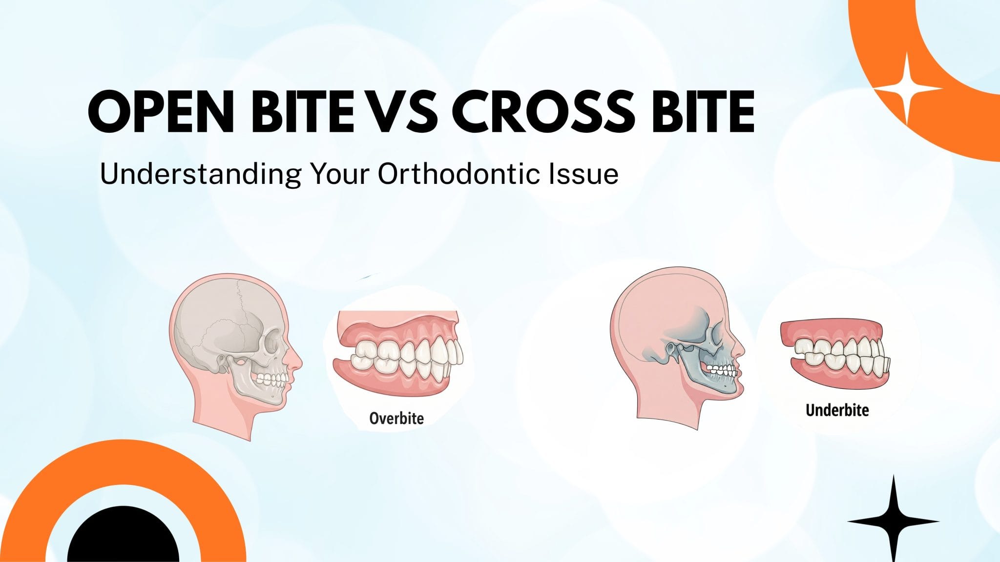 open bite vs cross bite