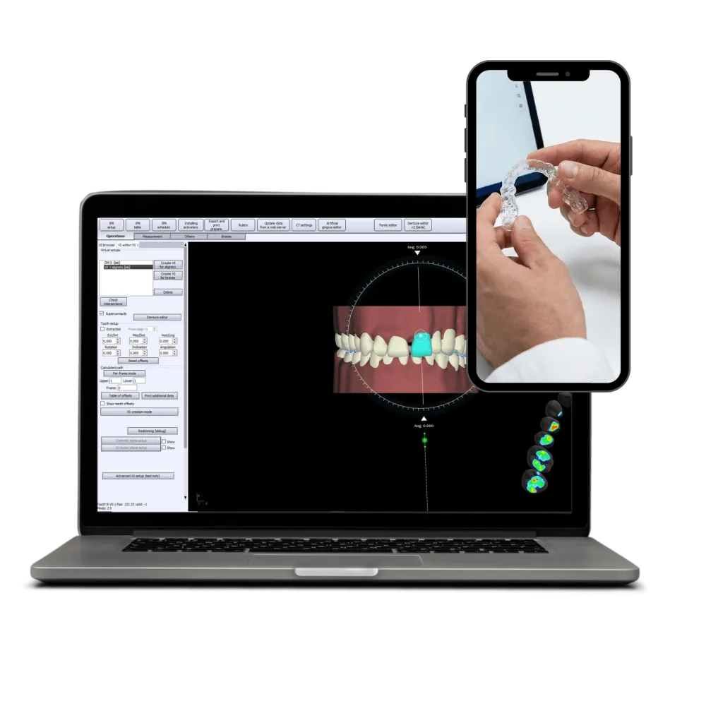 clear aligners 3d software