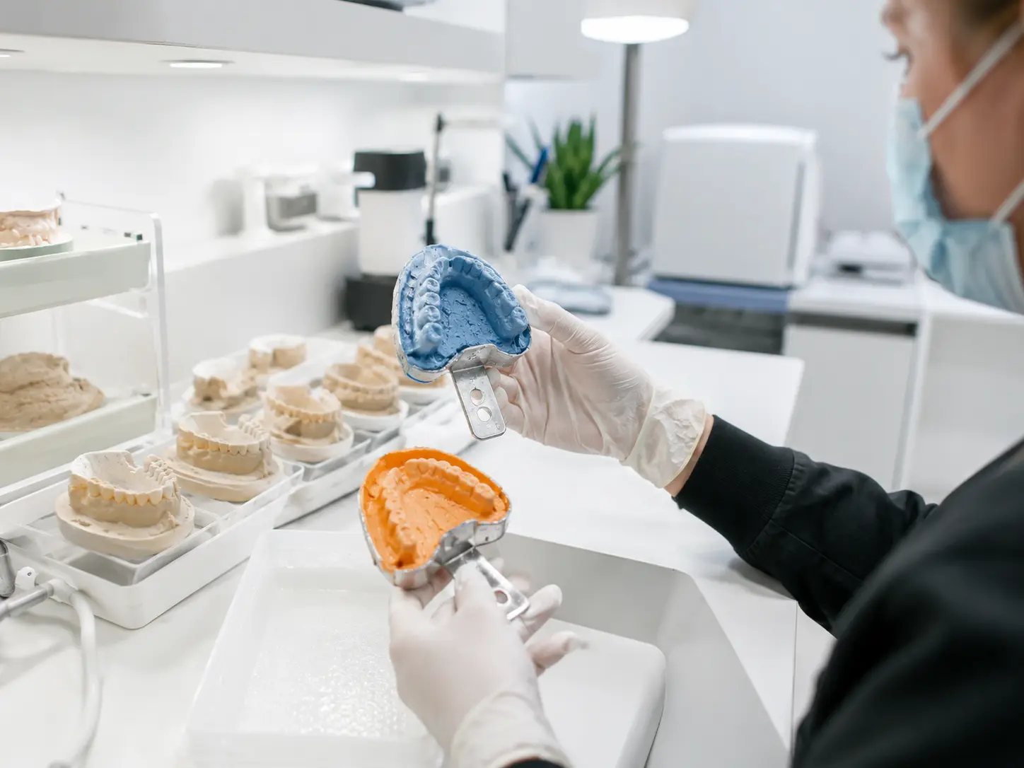 Receiving and preparing dental aligner impressions at Clear Moves Aligners