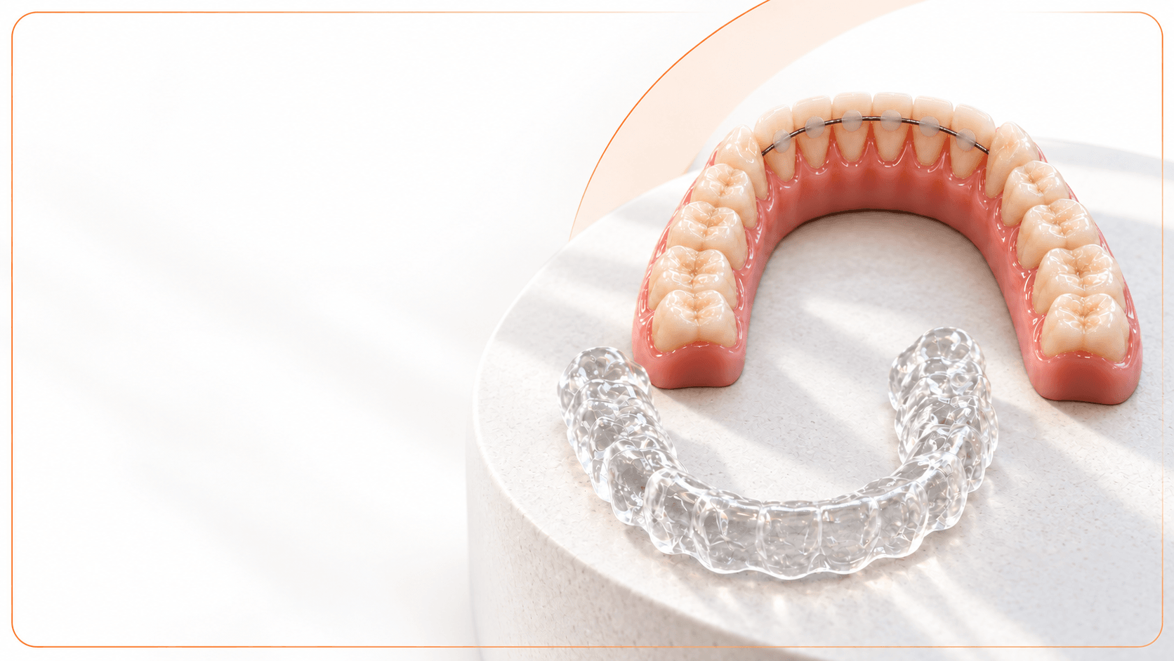Retention After Clear Aligner Treatment: A Practical Protocol for Clinicians