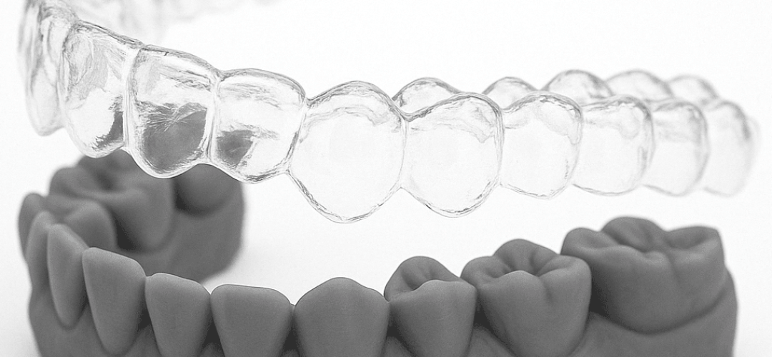 clear aligner material clear aligner material
